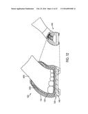 Decoupled Foot Stabilizer System diagram and image