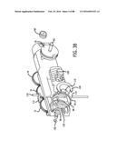 APPARATUS AND METHOD FOR MINIMALLY INVASIVE SUTURING diagram and image