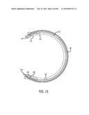 APPARATUS AND METHOD FOR MINIMALLY INVASIVE SUTURING diagram and image