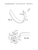 APPARATUS AND METHOD FOR MINIMALLY INVASIVE SUTURING diagram and image