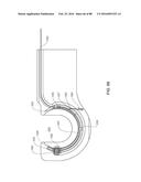 APPARATUS AND METHOD FOR MINIMALLY INVASIVE SUTURING diagram and image