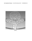 Advanced Endovascular Clip and Method of Using Same diagram and image