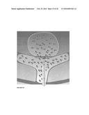 Advanced Endovascular Clip and Method of Using Same diagram and image