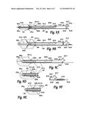 BALLOON CATHETER diagram and image