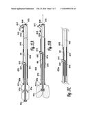 BALLOON CATHETER diagram and image