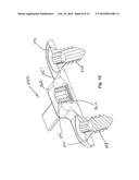 DEVICE AND METHOD FOR TREATMENT OF SPINAL DEFORMITY diagram and image