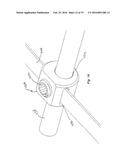 DEVICE AND METHOD FOR TREATMENT OF SPINAL DEFORMITY diagram and image