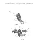 DEVICE AND METHOD FOR TREATMENT OF SPINAL DEFORMITY diagram and image