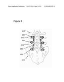 Flexible Spine Components diagram and image