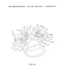 METHODS AND APPARATUS FOR STABILIZING BONE diagram and image