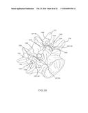 METHODS AND APPARATUS FOR STABILIZING BONE diagram and image