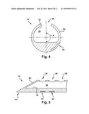 APPARATUS AND METHOD FOR TREATING A NEUROMUSCULAR DEFECT diagram and image