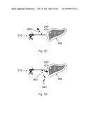 DEVICE AND METHOD FOR ASISSTING LAPAROSCOPIC SURGERY RULE BASED APPROACH diagram and image