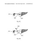 DEVICE AND METHOD FOR ASISSTING LAPAROSCOPIC SURGERY RULE BASED APPROACH diagram and image