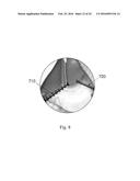 DEVICE AND METHOD FOR ASISSTING LAPAROSCOPIC SURGERY RULE BASED APPROACH diagram and image