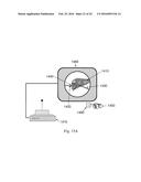 DEVICE AND METHOD FOR ASISSTING LAPAROSCOPIC SURGERY RULE BASED APPROACH diagram and image