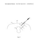 DEVICE AND METHOD FOR ASISSTING LAPAROSCOPIC SURGERY RULE BASED APPROACH diagram and image