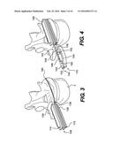 Vertebral Implants and Related Methods of Use diagram and image