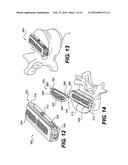 Vertebral Implants and Related Methods of Use diagram and image