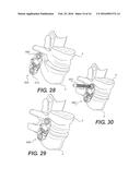 Vertebral Implants and Related Methods of Use diagram and image