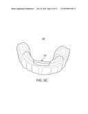 ORAL APPLIANCE diagram and image