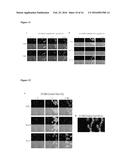 Compositions and Methods for Treating Cancer diagram and image