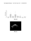 COMPOSITIONS AND METHODS FOR TREATMENT OF VESSEL DISEASE diagram and image