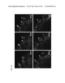 FUNCTIONALIZATION OF AND USE OF FUNCTIONALIZED SECOND HARMONIC GENERATING     NANOPROBES diagram and image