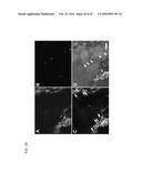 FUNCTIONALIZATION OF AND USE OF FUNCTIONALIZED SECOND HARMONIC GENERATING     NANOPROBES diagram and image