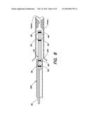 STABILIZING AND SEALING CATHETER FOR USE WITH A GUIDING CATHETER diagram and image