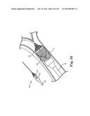 Devices and Systems for Access and Navigation of Cerebrospinal Fluid Space diagram and image