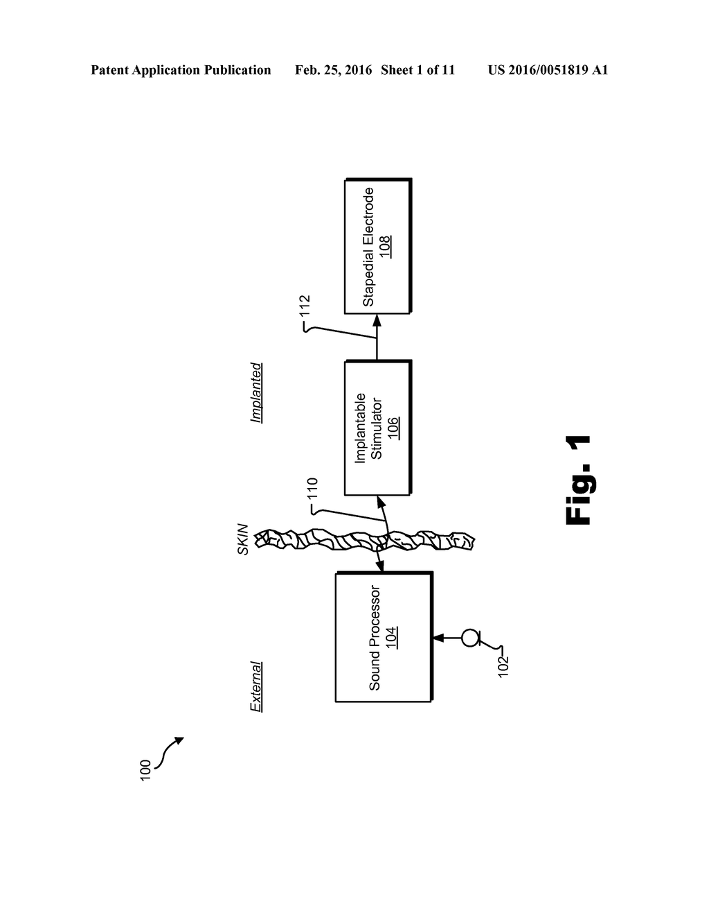 SYSTEMS AND METHODS FOR ELICITING A STAPEDIAL REFLEX TO PROTECT HEARING - diagram, schematic, and image 02