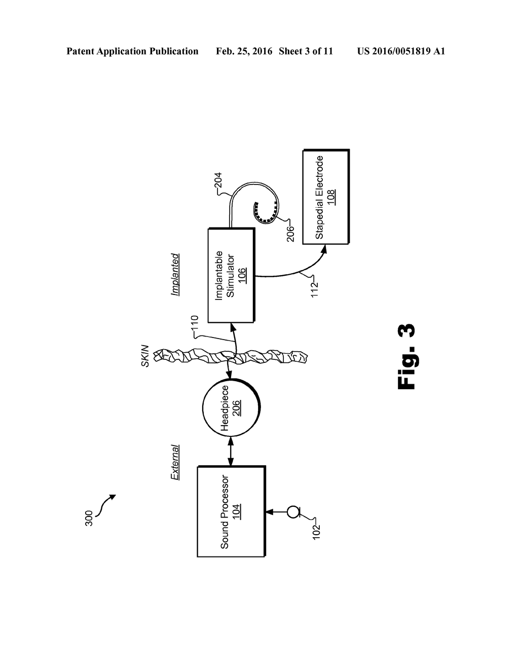 SYSTEMS AND METHODS FOR ELICITING A STAPEDIAL REFLEX TO PROTECT HEARING - diagram, schematic, and image 04