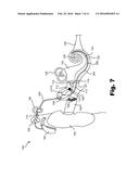 SYSTEMS AND METHODS FOR ELICITING A STAPEDIAL REFLEX TO PROTECT HEARING diagram and image