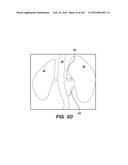 SYSTEM AND METHOD FOR OPTOGENETIC THERAPY diagram and image