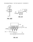 SYSTEM AND METHOD FOR OPTOGENETIC THERAPY diagram and image