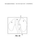 SYSTEM AND METHOD FOR OPTOGENETIC THERAPY diagram and image