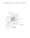 SYSTEM AND METHOD FOR OPTOGENETIC THERAPY diagram and image