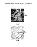 FIBROUS NONWOVEN AND METHOD FOR THE PRODUCTION THEREOF diagram and image