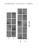 SMALL MOLECULE MEDIATED TRANSCRIPTIONAL INDUCTION OF E-CADHERIN diagram and image