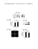 Bruton s Tyrosine Kinase As Anti-Cancer Drug Target diagram and image