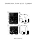 Bruton s Tyrosine Kinase As Anti-Cancer Drug Target diagram and image