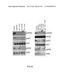 Bruton s Tyrosine Kinase As Anti-Cancer Drug Target diagram and image