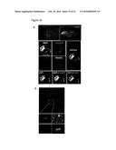 PERFORIN 2 DEFENSE AGAINST INVASIVE AND MULTIDRUG RESISTANT PATHOGENS diagram and image