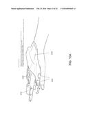 EXTERNAL CAMERA FOR A PORTABLE ELECTRONIC DEVICE diagram and image