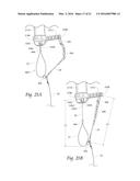 FISH HOOK SYSTEM diagram and image