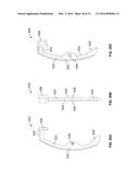 Can Dispenser diagram and image