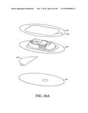 SYSTEMS AND METHODS FOR SECURING A CONTINUOUS ANALYTE SENSOR TO A HOST diagram and image