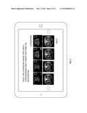 IMAGE REGISTRATION FOR CT OR MR IMAGERY AND ULTRASOUND IMAGERY USING     MOBILE DEVICE diagram and image