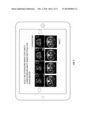 IMAGE REGISTRATION FOR CT OR MR IMAGERY AND ULTRASOUND IMAGERY USING     MOBILE DEVICE diagram and image